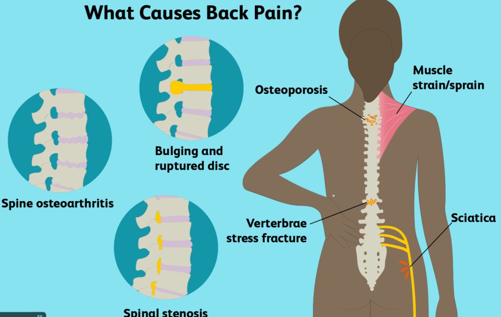 Back Pain Relief