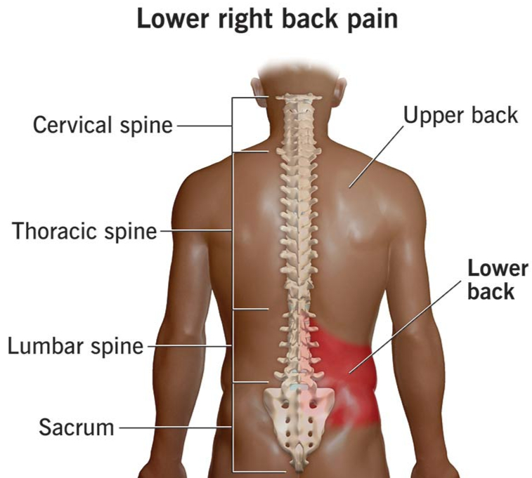 Lower Back Pain