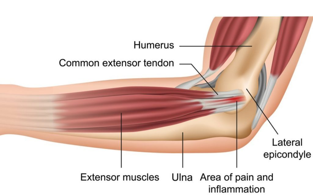 Elbow Joint Pain