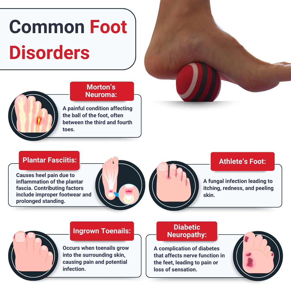 Foot Pain