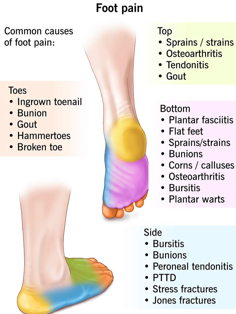 Foot Pain