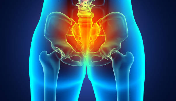 Tailbone Pain Relief