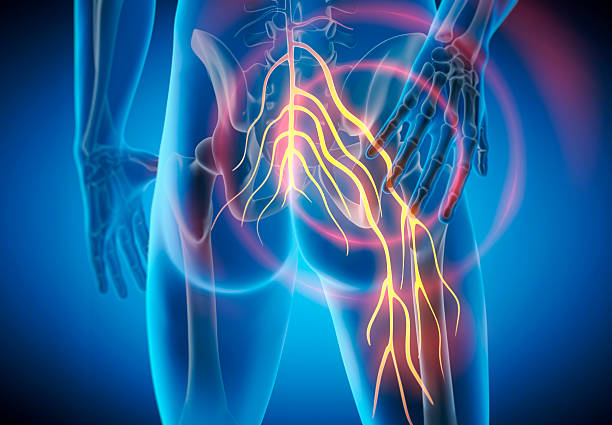 Sciatic Nerve Stretches
