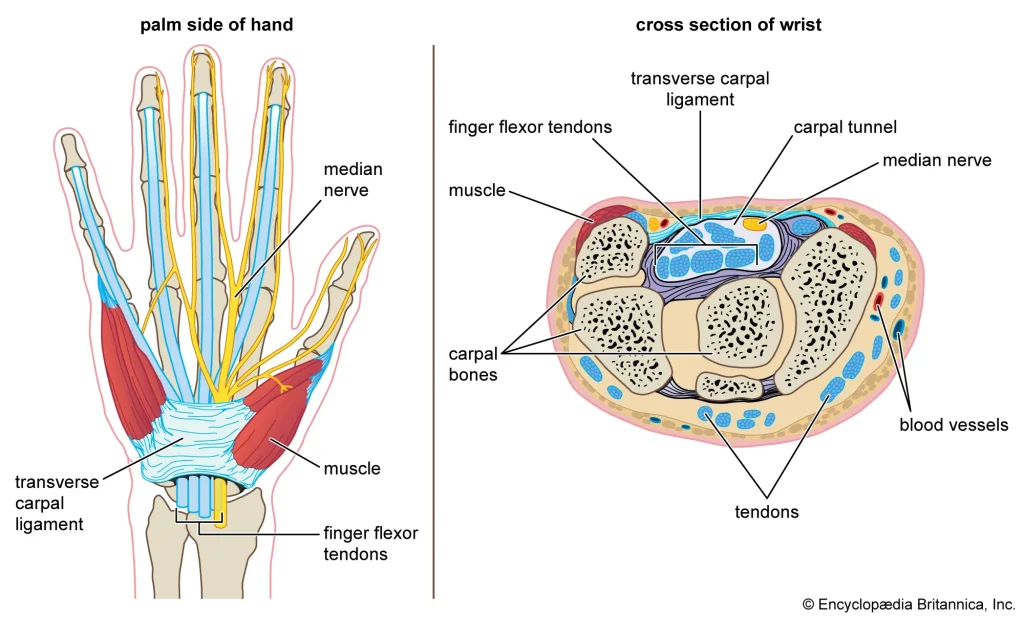 Carpal Tunnel Syndrome