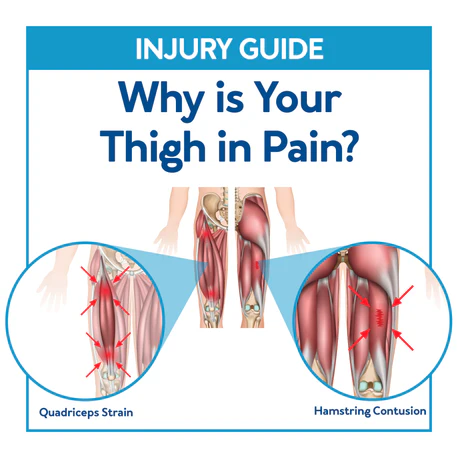 Thigh Pain