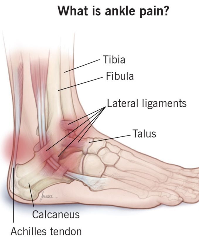 Ankle Pain Relief