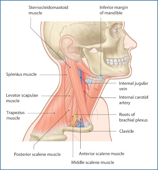 Stiff Neck