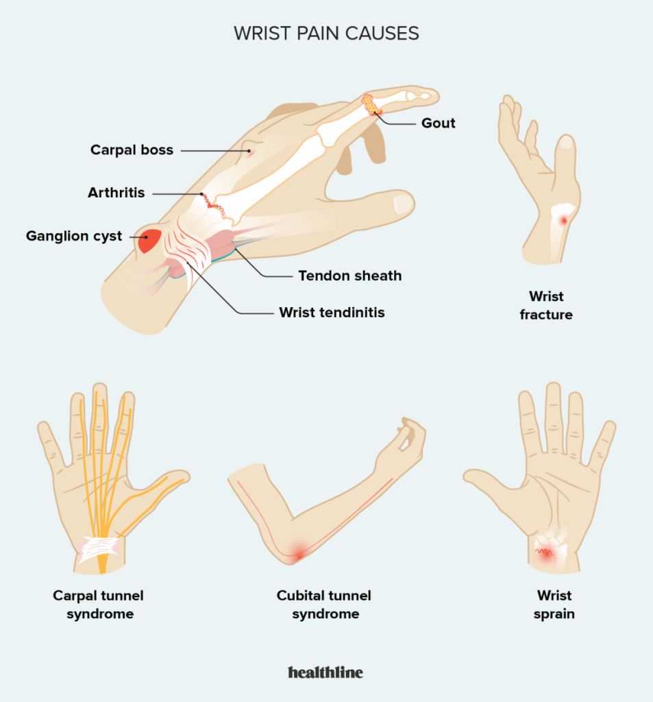 Wrist Joint pain