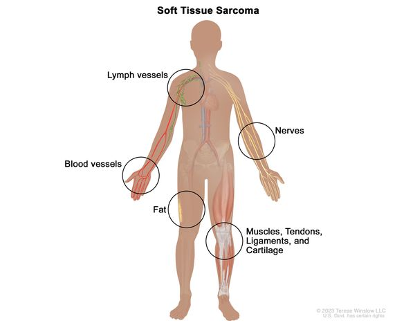 Deep Tissue Injury
