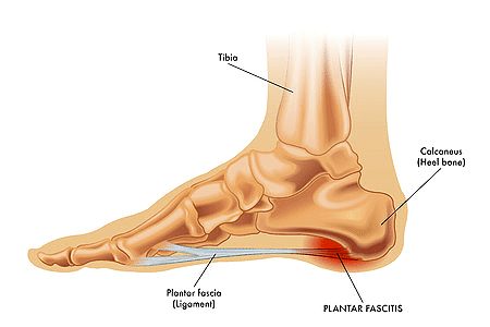 Ankle Pain Relief