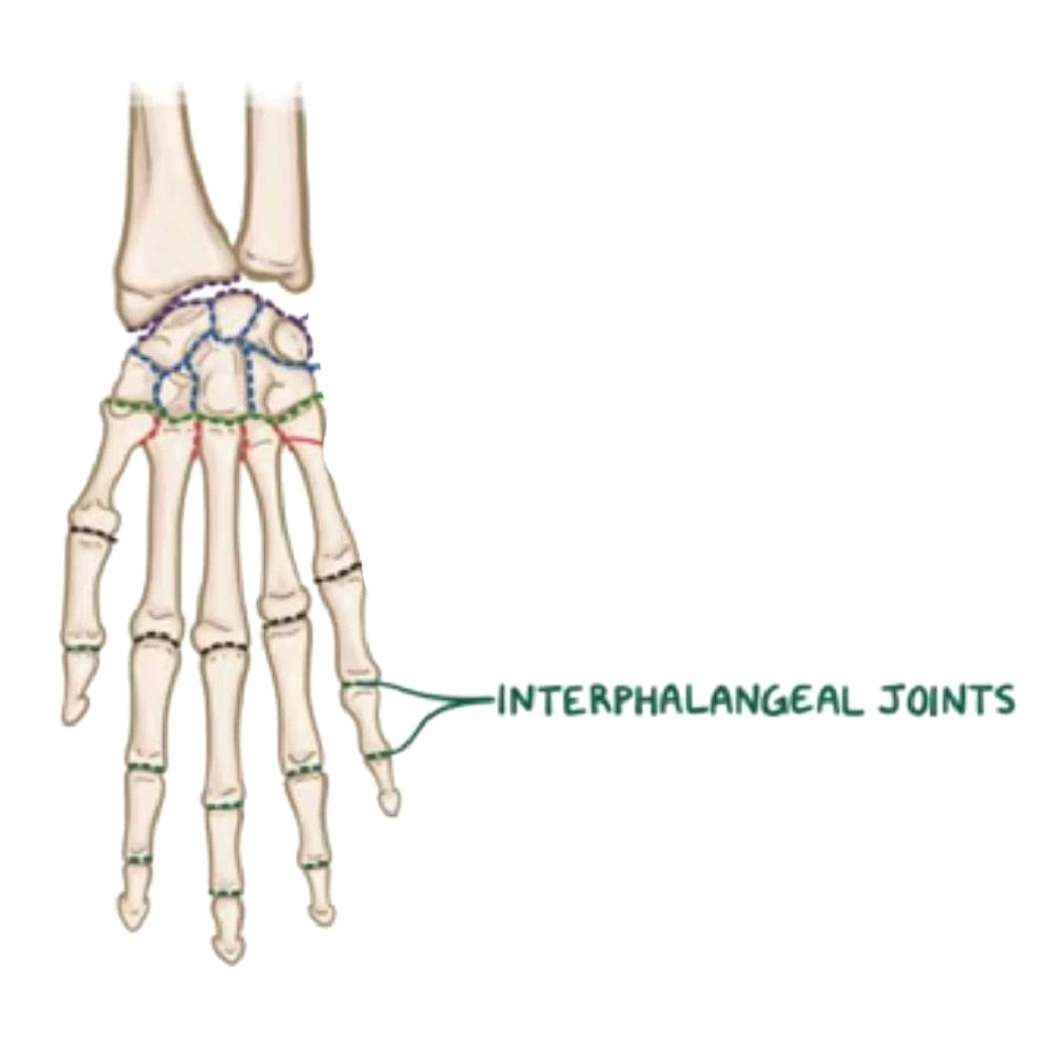 Interphalangeal Joint Pain
