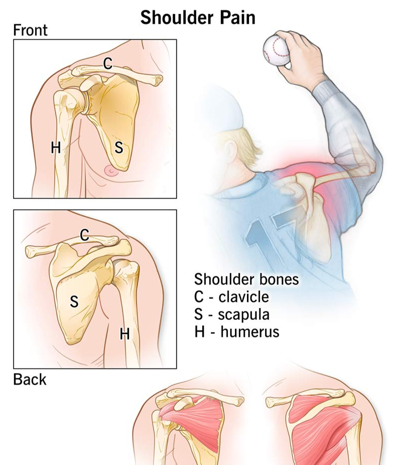 Right Shoulder Pain